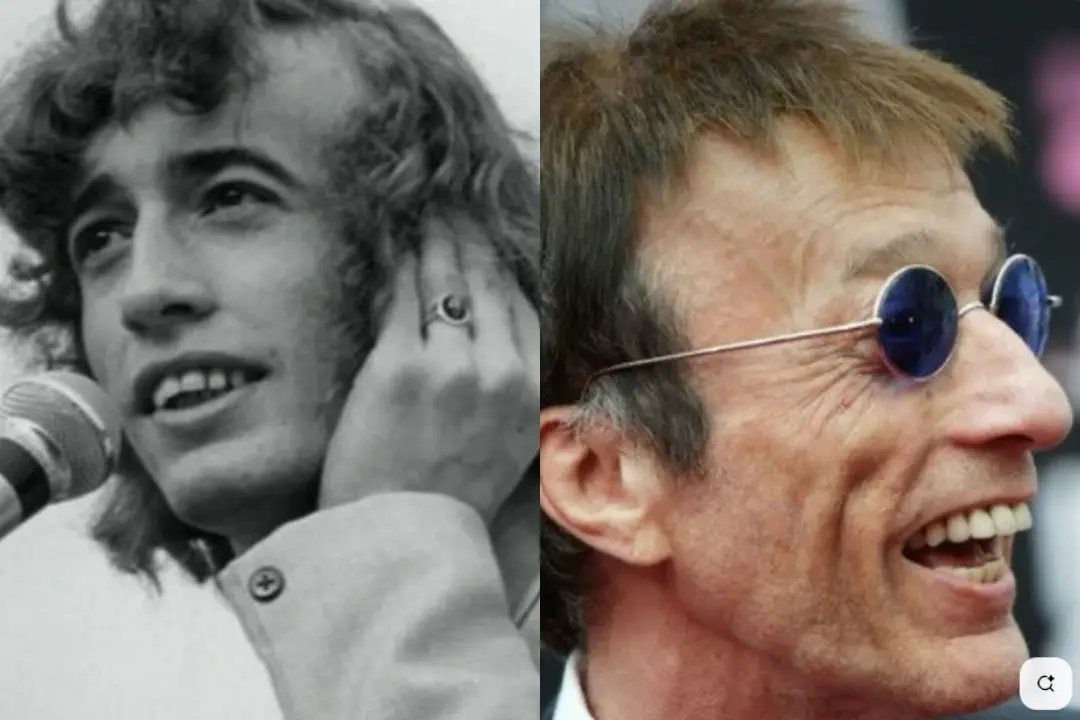 Robert Gibb teeth implant before after